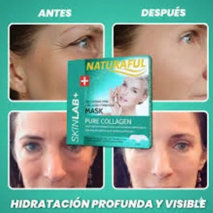 Parches colágeno absorbentes NATURAFUL (50% dcto en la 2da unidad)